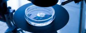 Donor Sperm Insemination Might be a Viable Option For IVF