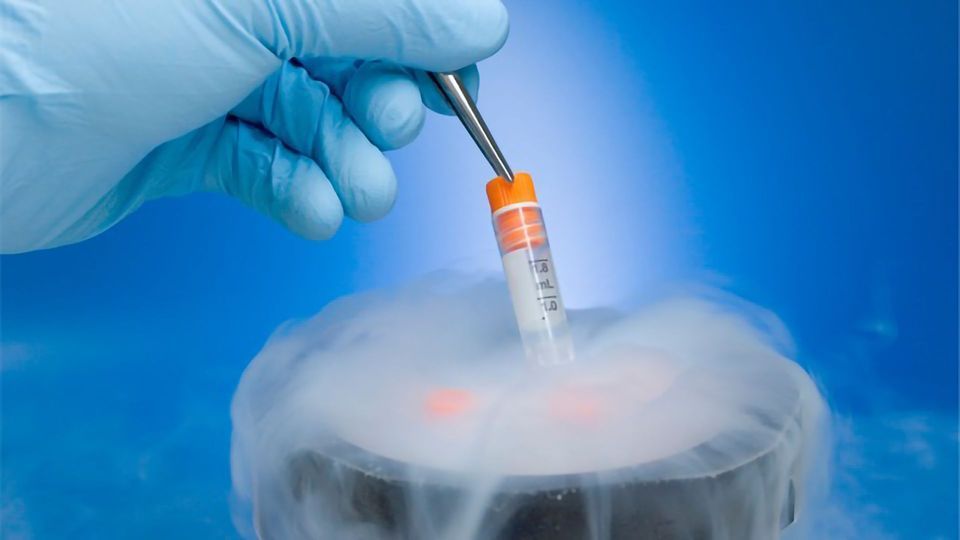 Gamete And Embryo Cryopreservation In Nigeria 